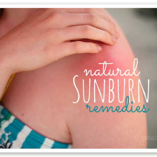 Natural sunburn remedies that you may already have on hand for instant relief when you get too much sun