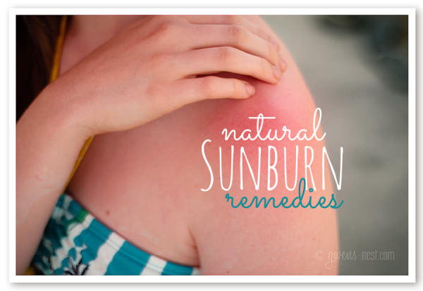 Natural sunburn remedies that you may already have on hand for instant relief when you get too much sun