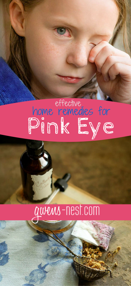 home remedy for pink eye pin2